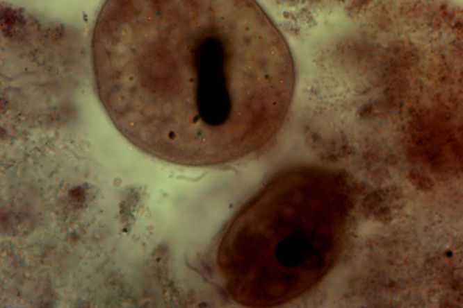 Vakovka střevní (Balantidium coli) pod mikroskopem.
